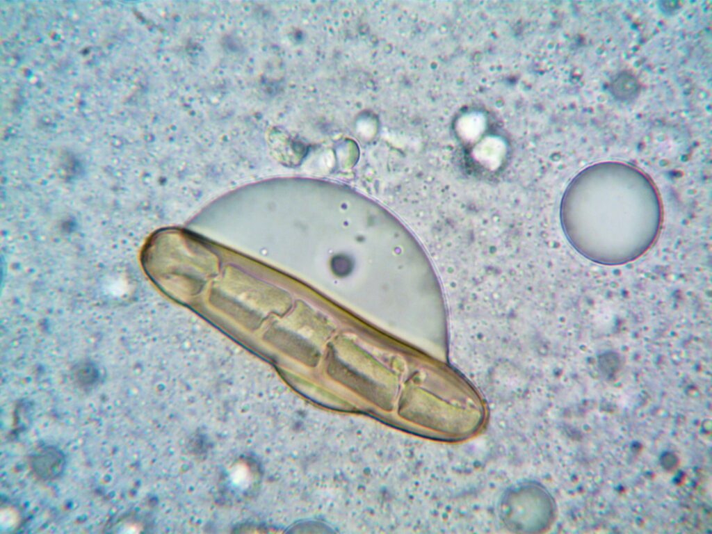 Extreme close-up of a spore and cell structures observed under a microscope, highlighting intricate biology details.